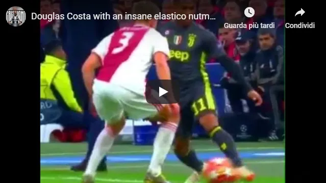 Tunnel con elastico di Douglas Costa. Adani e Trevisani senza parole: “Madre mia”