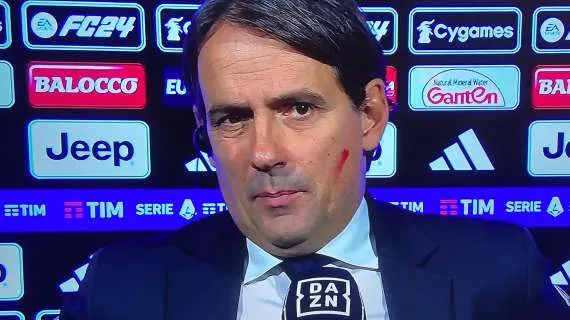 Inzaghi si arrabbia: un dossier di 5 errori arbitrali contro l’Inter